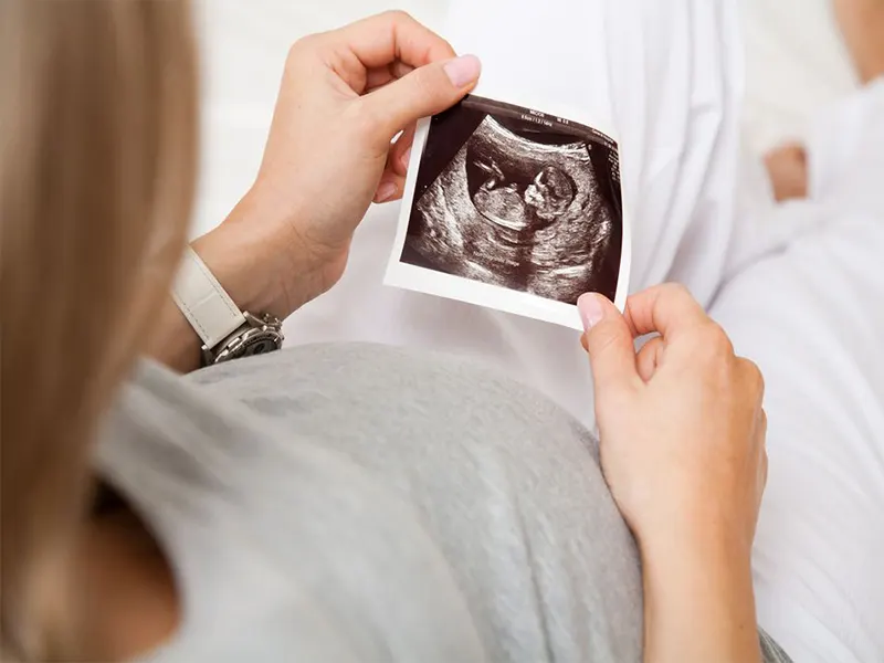 تعیین جنسیت