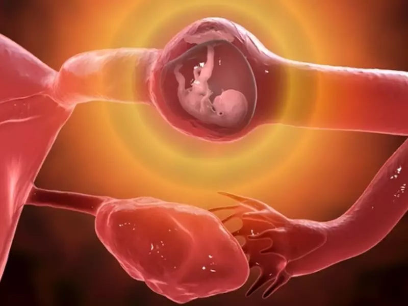 حاملگی خارج از رحم