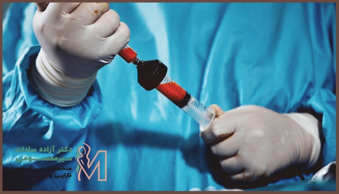 تزریق چربی به واژن چقدر ماندگار است؟