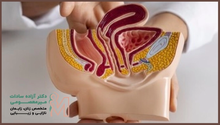 دکتر میر اسماعیلی جراح پرینورافی در اصفهان