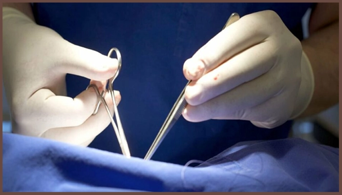 عمل لابیاپلاستی چگونه انجام می‌شود؟ 