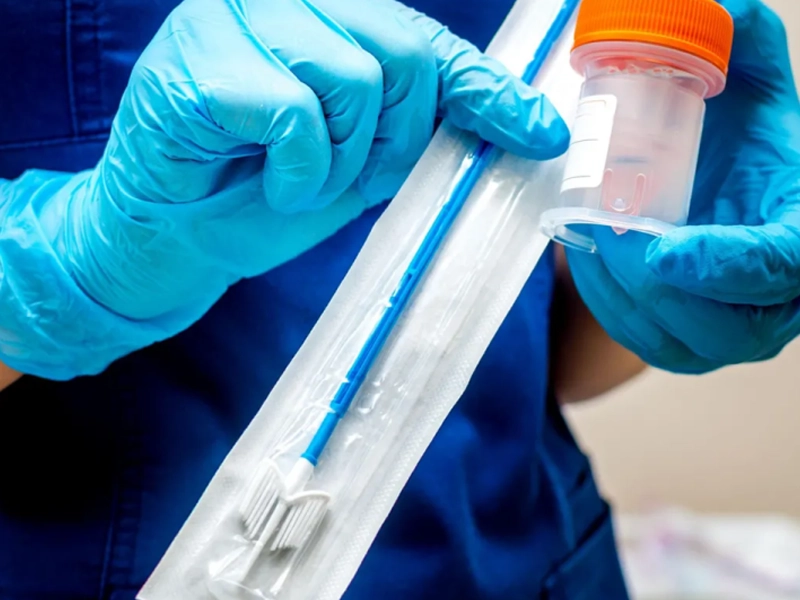 تست پاپ اسمیر در اصفهان