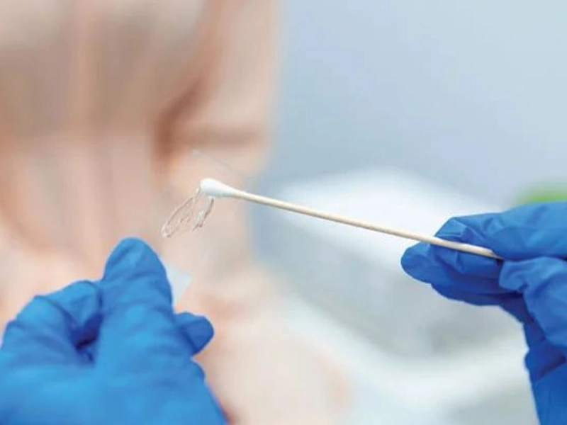 زگیل تناسلی در دختران مجرد